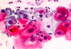 Uterine Cervix Cytopathology – Cellnetpathology.com