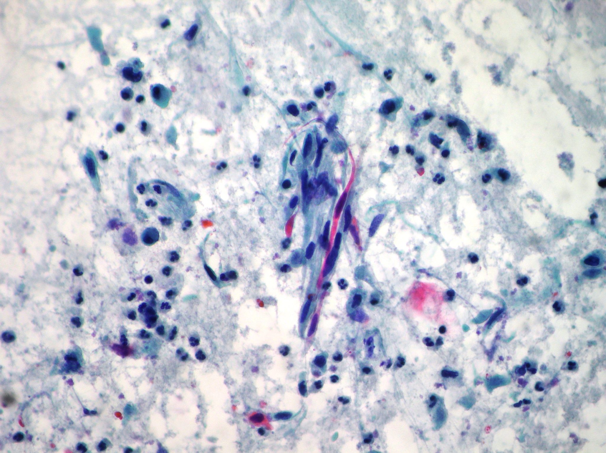 Uterine Cervix Cytopathology – Cellnetpathology.com