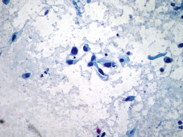 Uterine Cervix Cytopathology – Cellnetpathology.com